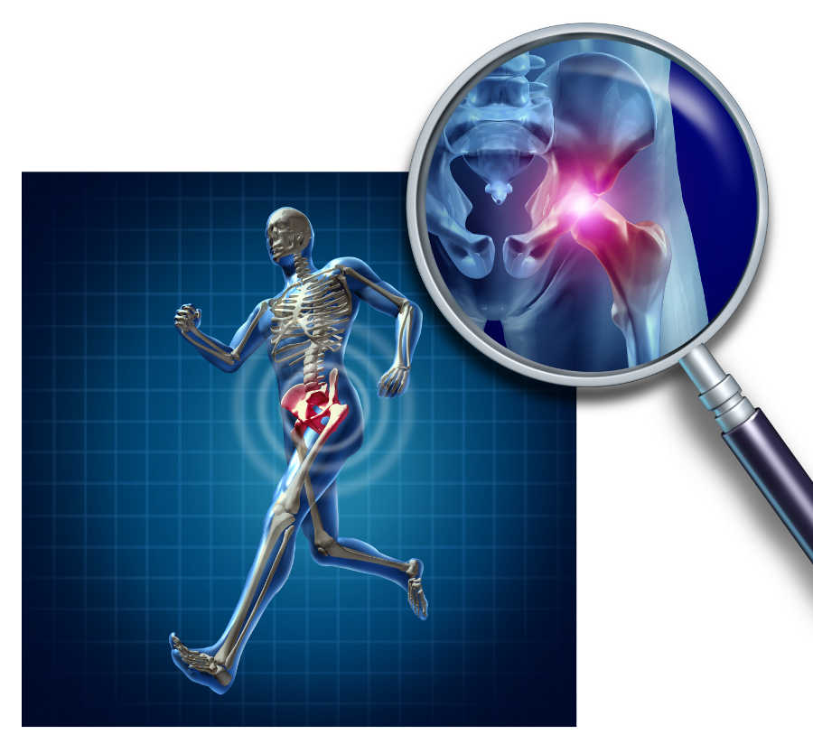Running-athlete-with-hip-pain-and-requiring-chiropractic-care-2.jpg
