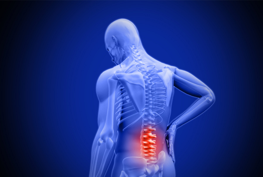 Person-with-poor-posture-that-needs-to-see-a-chiropractor.jpg
